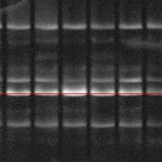 明胶酶谱MMP(2/9)检测实验
