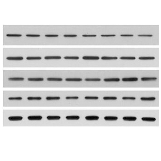 蛋白质免疫印迹(Western Blot, WB )